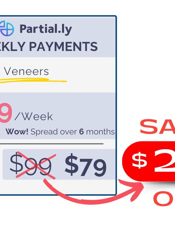 Weekly Payment Plan - Pop On Veneers with At Home Impression Kit - $20 Off