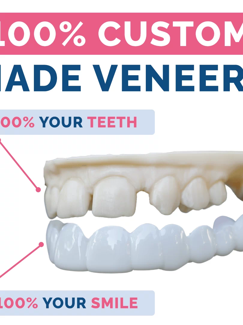 PDP_100_ CUSTOM MADE VENEERS.png